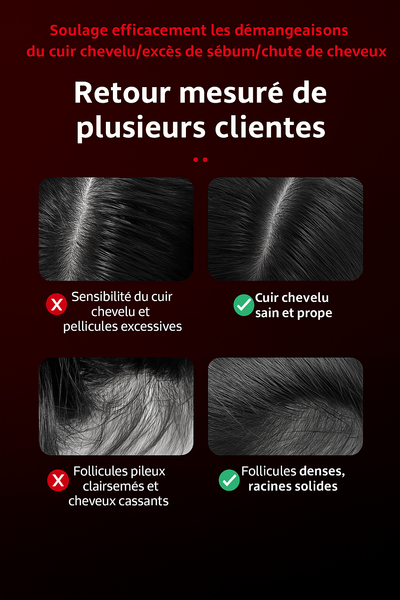 Brosse massante électrique cuir chevelu